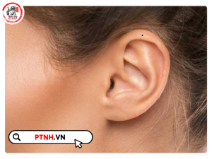 các vị trí nốt ruồi ở tai