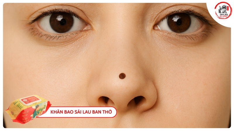 Ý Nghĩa Sự Nghiệp Và Thành Công Của Nốt Ruồi Ở Đầu Mũi Nữ